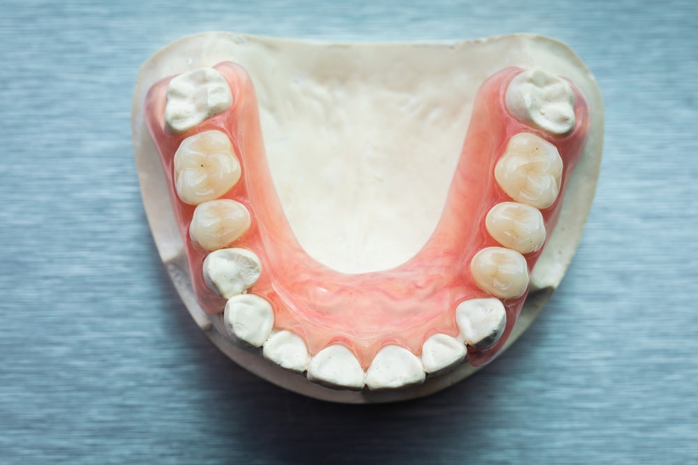 Из какого материала изготовлены зубные имплантаты?
